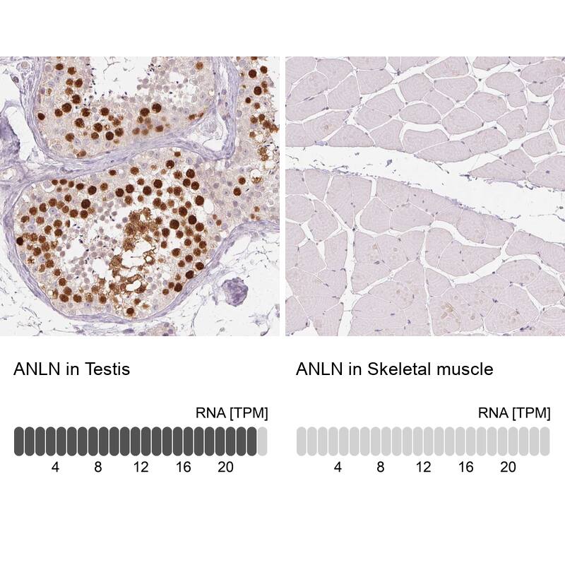 Anillin Antibody (CL0303) - Azide and BSA Free Immunohistochemistry-Paraffin: Anillin Antibody [NBP3-43945]