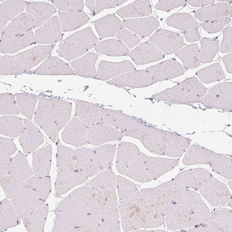 Anillin Antibody (CL0303) - Azide and BSA Free Immunohistochemistry-Paraffin: Anillin Antibody [NBP3-43945]