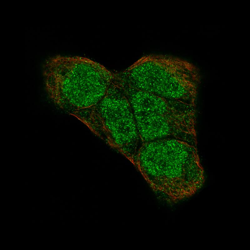 PI 3-Kinase p110 beta/PIK3CB Antibody (CL9518) - Azide and BSA Free Immunocytochemistry/ Immunofluorescence: PI 3-Kinase p110 beta/PIK3CB Antibody [NBP3-43948]