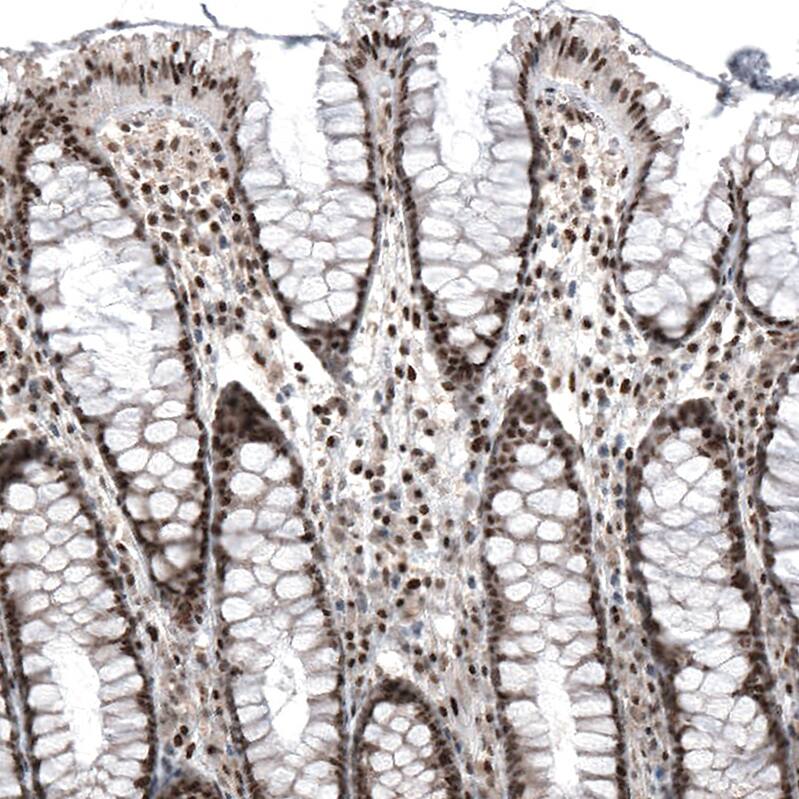 PI 3-Kinase p110 beta/PIK3CB Antibody (CL9518) - Azide and BSA Free Immunohistochemistry-Paraffin: PI 3-Kinase p110 beta/PIK3CB Antibody [NBP3-43948]