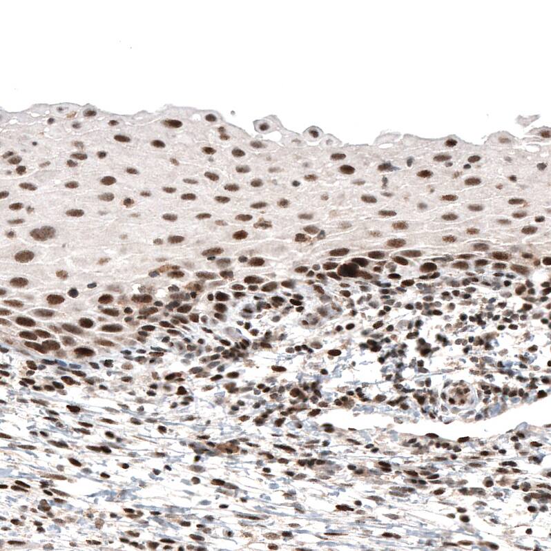 PI 3-Kinase p110 beta/PIK3CB Antibody (CL9518) - Azide and BSA Free Immunohistochemistry-Paraffin: PI 3-Kinase p110 beta/PIK3CB Antibody [NBP3-43948]