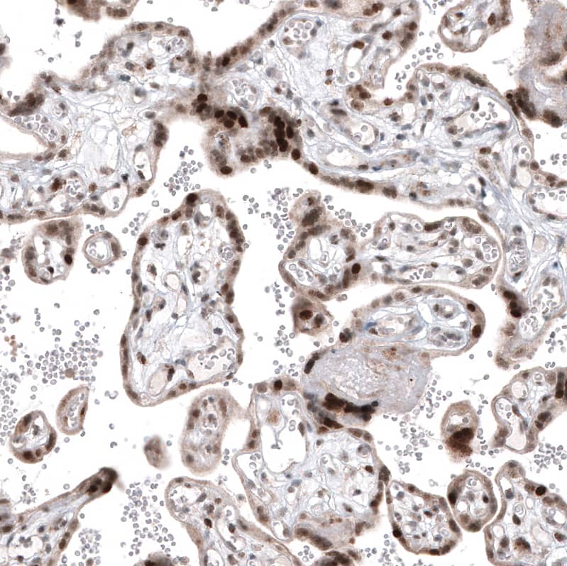 PI 3-Kinase p110 beta/PIK3CB Antibody (CL9518) - Azide and BSA Free Immunohistochemistry-Paraffin: PI 3-Kinase p110 beta/PIK3CB Antibody [NBP3-43948]