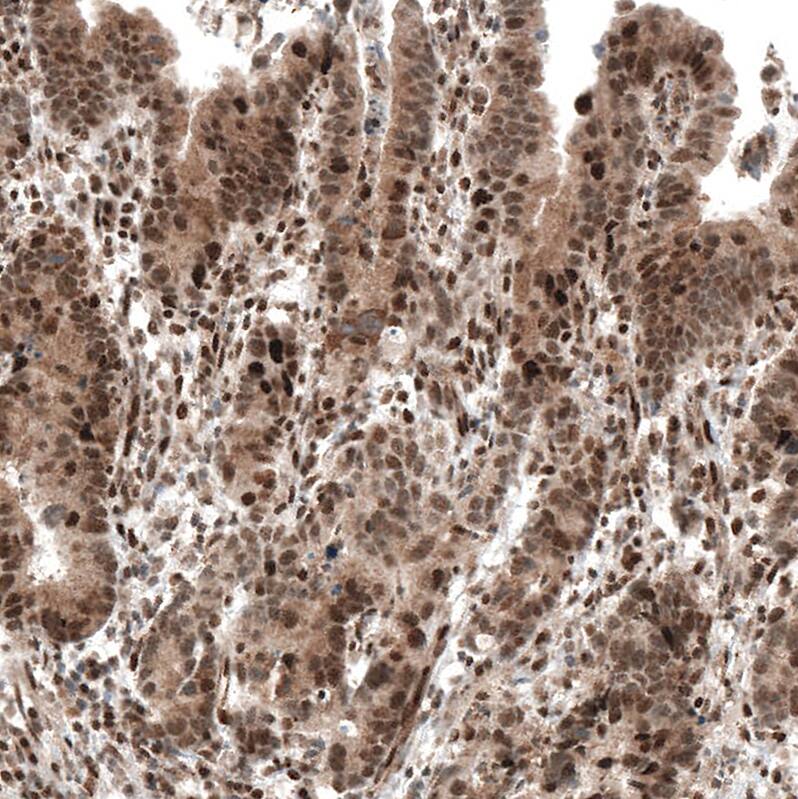 PI 3-Kinase p110 beta/PIK3CB Antibody (CL9518) - Azide and BSA Free Immunohistochemistry-Paraffin: PI 3-Kinase p110 beta/PIK3CB Antibody [NBP3-43948]