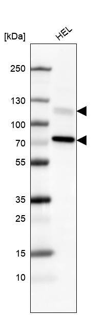 PI 3-Kinase p110 beta/PIK3CB Antibody (CL9518) - Azide and BSA Free Western Blot: PI 3-Kinase p110 beta/PIK3CB Antibody [NBP3-43948]