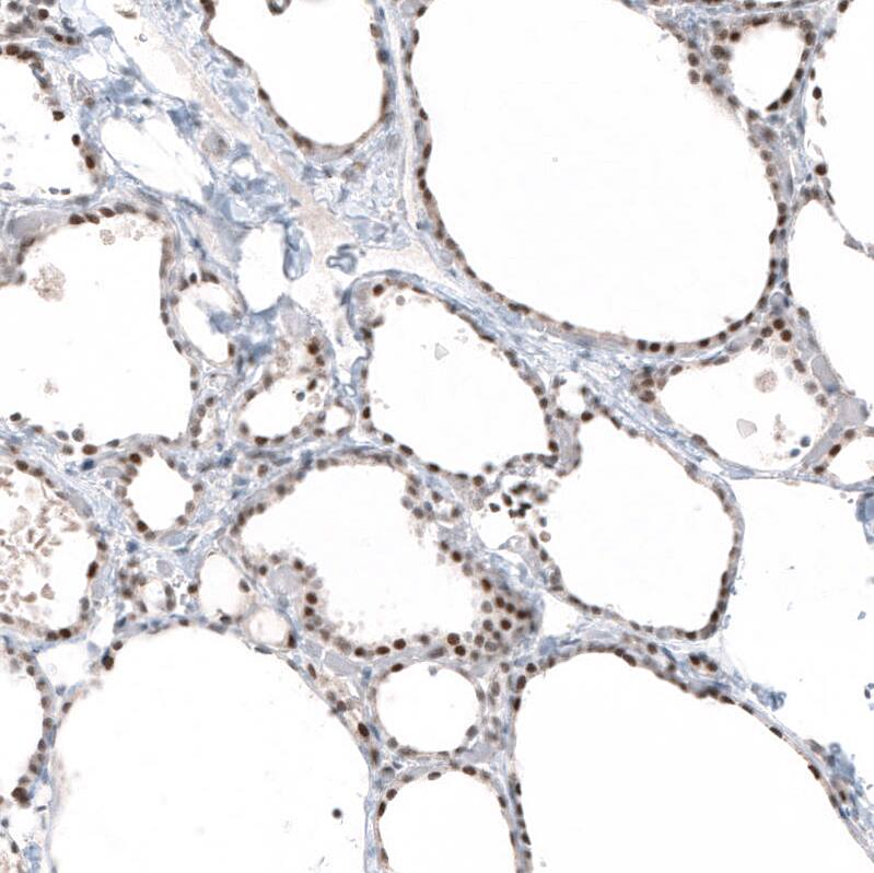 PI 3-Kinase p110 beta/PIK3CB Antibody (CL9518) - Azide and BSA Free Immunohistochemistry-Paraffin: PI 3-Kinase p110 beta/PIK3CB Antibody [NBP3-43948]