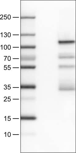 SATB2 Antibody (CL0323) - Azide and BSA Free Western Blot: SATB2 Antibody [NBP3-43950]