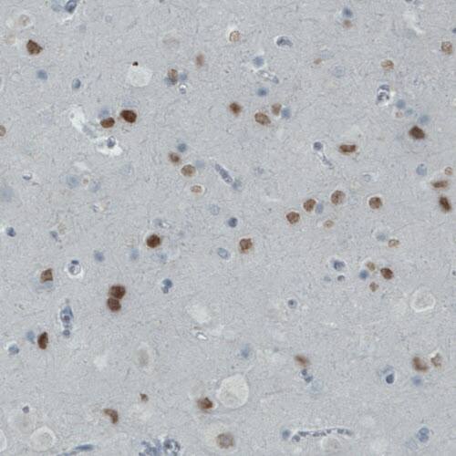 SATB2 Antibody (CL0323) - Azide and BSA Free Immunohistochemistry-Paraffin: SATB2 Antibody [NBP3-43950]