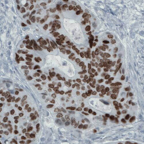 SATB2 Antibody (CL0323) - Azide and BSA Free Immunohistochemistry-Paraffin: SATB2 Antibody [NBP3-43950]