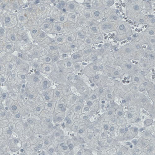 SATB2 Antibody (CL0323) - Azide and BSA Free Immunohistochemistry-Paraffin: SATB2 Antibody [NBP3-43950]