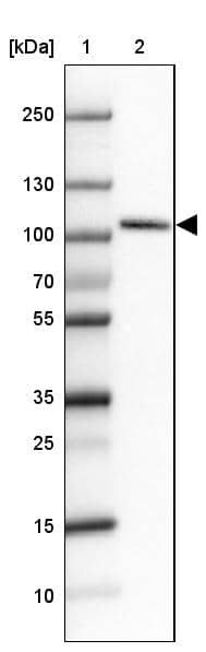 SATB2 Antibody (CL0323) - Azide and BSA Free Western Blot: SATB2 Antibody [NBP3-43950]