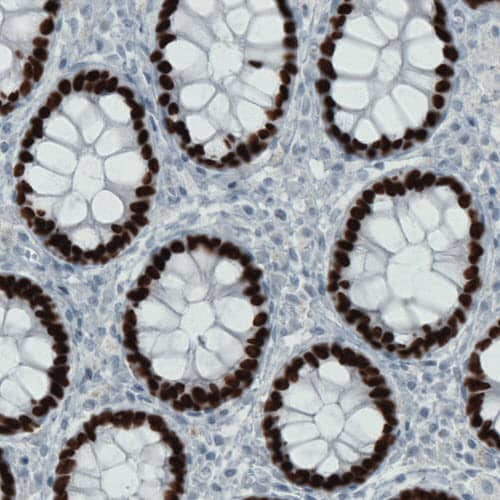 SATB2 Antibody (CL0323) - Azide and BSA Free Immunohistochemistry-Paraffin: SATB2 Antibody [NBP3-43950]