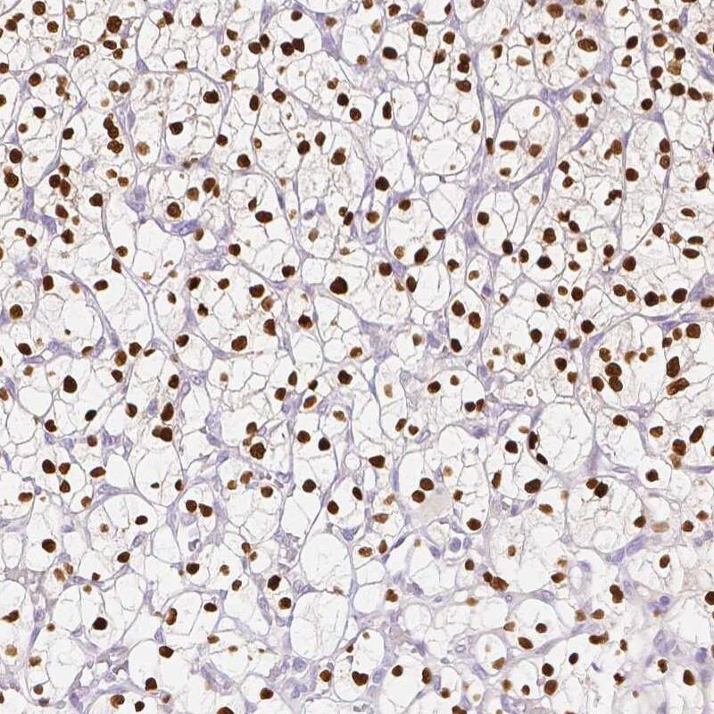 TCF-2/HNF-1 beta Antibody (CL0374) - Azide and BSA Free Immunohistochemistry-Paraffin: TCF-2/HNF-1 beta Antibody [NBP3-43951]