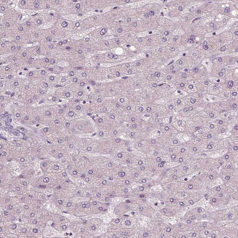 RNASE7 Antibody (CL0223) - Azide and BSA Free Immunohistochemistry-Paraffin: RNASE7 Antibody [NBP3-43952]