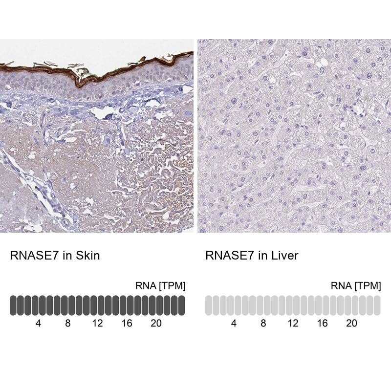 RNASE7 Antibody (CL0224) - Azide and BSA Free Immunohistochemistry-Paraffin: RNASE7 Antibody [NBP3-43953]