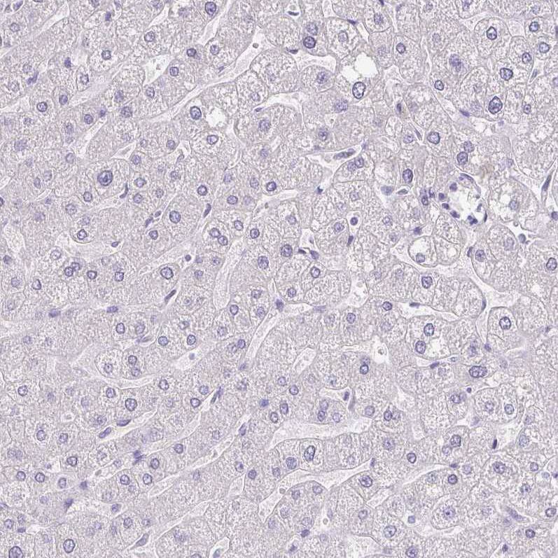RNASE7 Antibody (CL0224) - Azide and BSA Free Immunohistochemistry-Paraffin: RNASE7 Antibody [NBP3-43953]