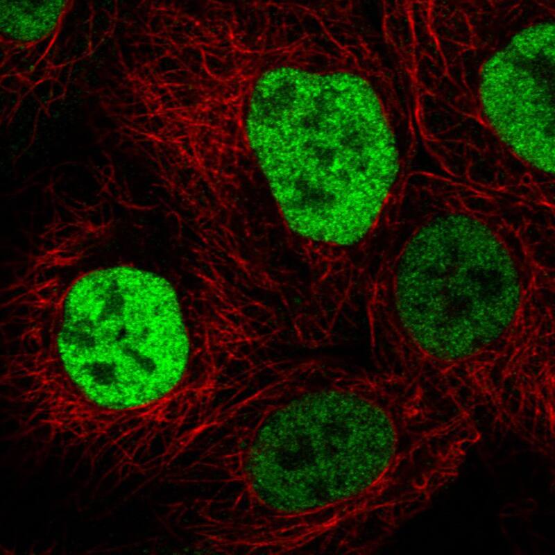 p53 Antibody (CL2199) - Azide and BSA Free Immunocytochemistry/ Immunofluorescence: p53 Antibody [NBP3-43954]