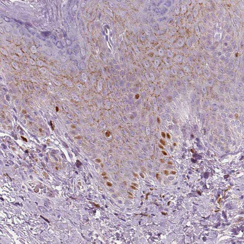 p53 Antibody (CL2199) - Azide and BSA Free Immunohistochemistry-Paraffin: p53 Antibody [NBP3-43954]