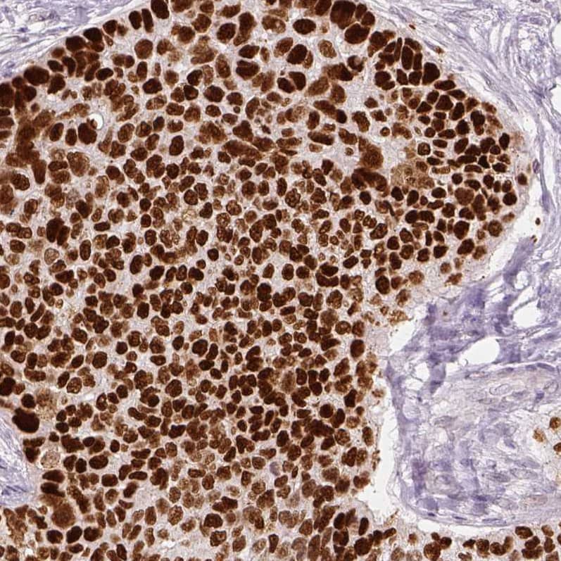 p53 Antibody (CL2199) - Azide and BSA Free Immunohistochemistry-Paraffin: p53 Antibody [NBP3-43954]