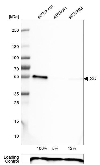 p53 Antibody (CL2199) - Azide and BSA Free Western Blot: p53 Antibody [NBP3-43954]