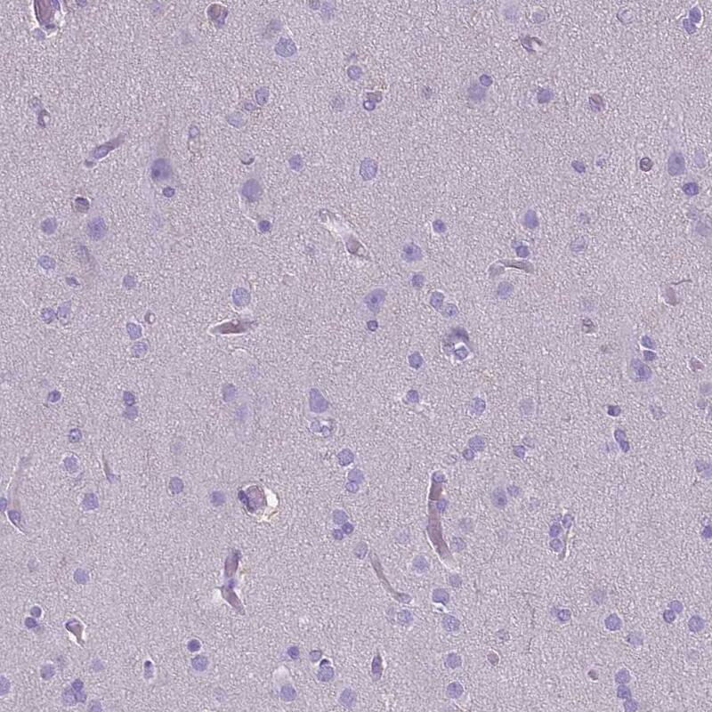 CD40/TNFRSF5 Antibody (CL1673) - Azide and BSA Free Immunohistochemistry-Paraffin: CD40/TNFRSF5 Antibody [NBP3-43956]