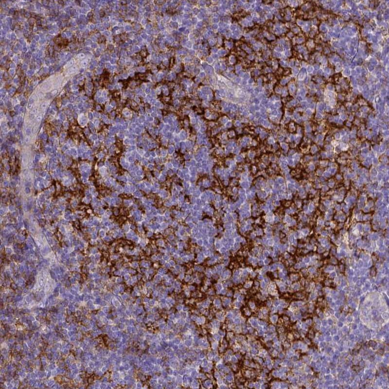 CD40/TNFRSF5 Antibody (CL1673) - Azide and BSA Free Immunohistochemistry-Paraffin: CD40/TNFRSF5 Antibody [NBP3-43956]