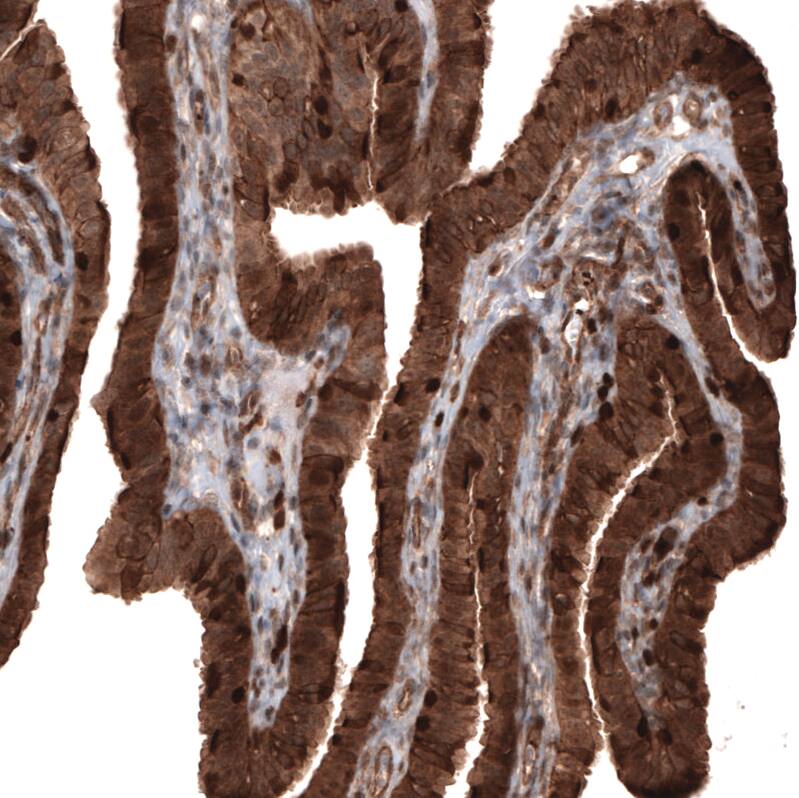 Profilin 1 Antibody (CL3524) - Azide and BSA Free Immunohistochemistry-Paraffin: Profilin 1 Antibody [NBP3-43957]