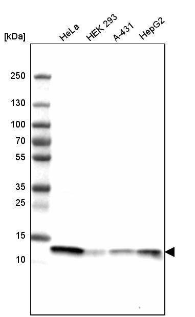 Profilin 1 Antibody (CL3524) - Azide and BSA Free Western Blot: Profilin 1 Antibody [NBP3-43957]