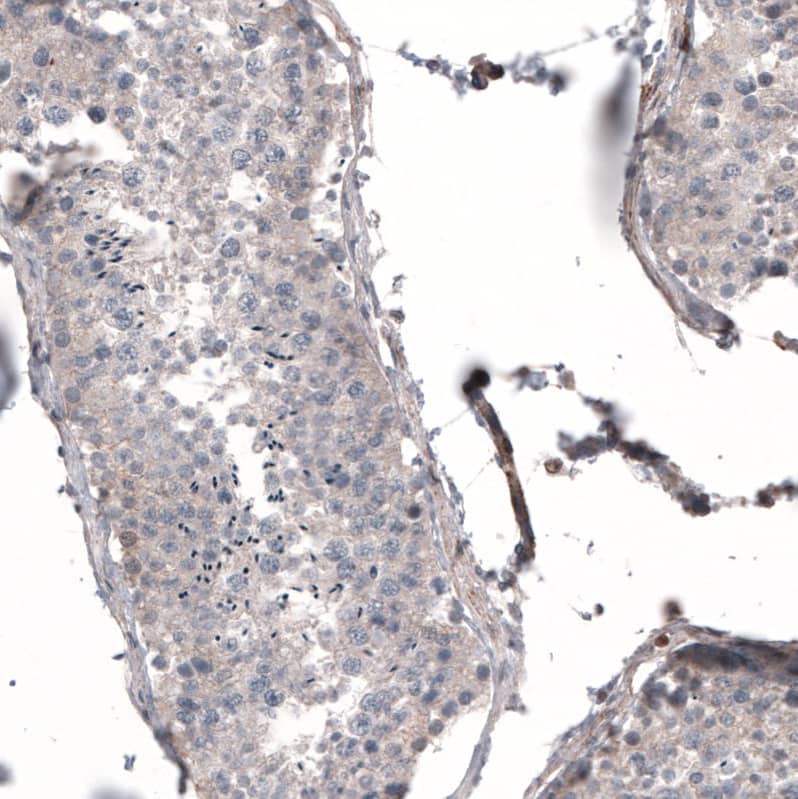 Profilin 1 Antibody (CL3524) - Azide and BSA Free Immunohistochemistry-Paraffin: Profilin 1 Antibody [NBP3-43957]