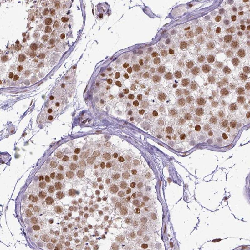 ERCC1 Antibody (CL1249) - Azide and BSA Free Immunohistochemistry-Paraffin: ERCC1 Antibody [NBP3-43959]