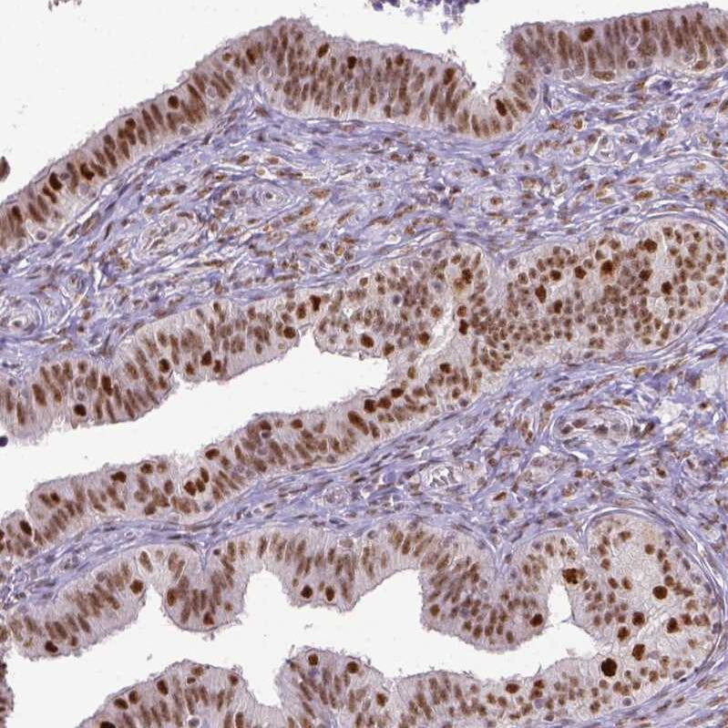 ERCC1 Antibody (CL1284) - Azide and BSA Free Immunohistochemistry-Paraffin: ERCC1 Antibody [NBP3-43960]