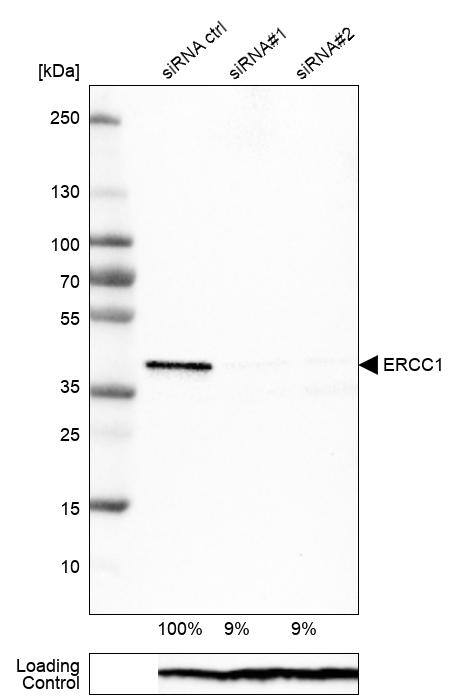 ERCC1 Antibody (CL1284) - Azide and BSA Free Western Blot: ERCC1 Antibody [NBP3-43960]