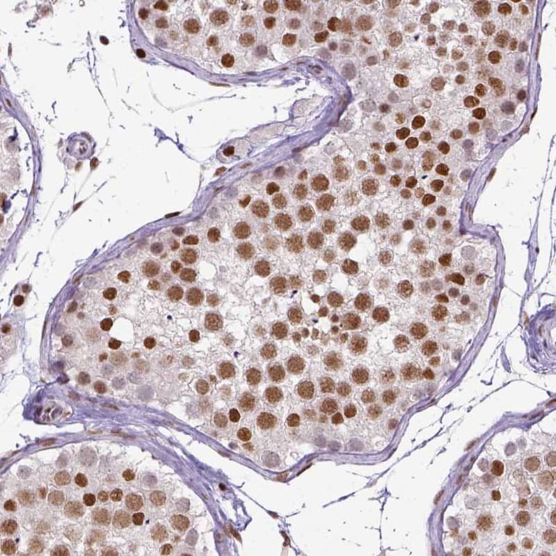 ERCC1 Antibody (CL1284) - Azide and BSA Free Immunohistochemistry-Paraffin: ERCC1 Antibody [NBP3-43960]