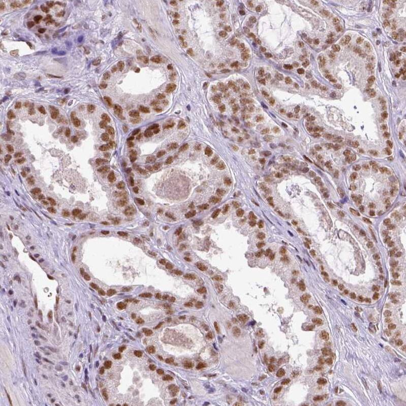 ERCC1 Antibody (CL1284) - Azide and BSA Free Immunohistochemistry-Paraffin: ERCC1 Antibody [NBP3-43960]