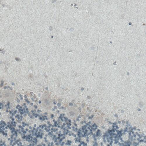 ITIH4 Antibody (CL1858) - Azide and BSA Free Immunohistochemistry-Paraffin: ITIH4 Antibody [NBP3-43963]