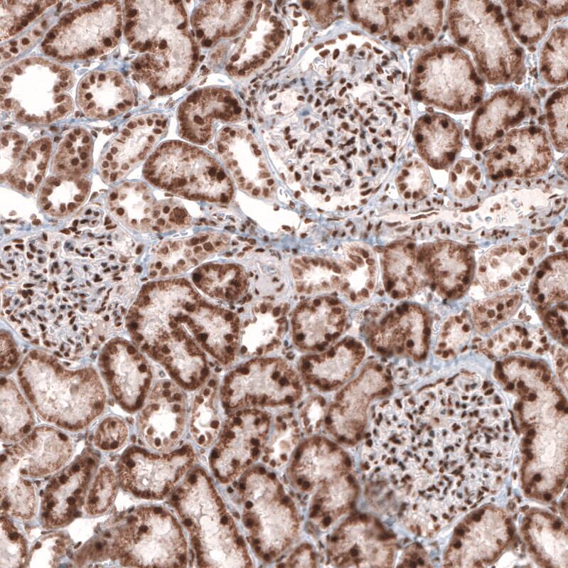 CDP/CUTL1 Antibody (CL5275) - Azide and BSA Free Immunohistochemistry-Paraffin: CDP/CUTL1 Antibody [NBP3-43964]