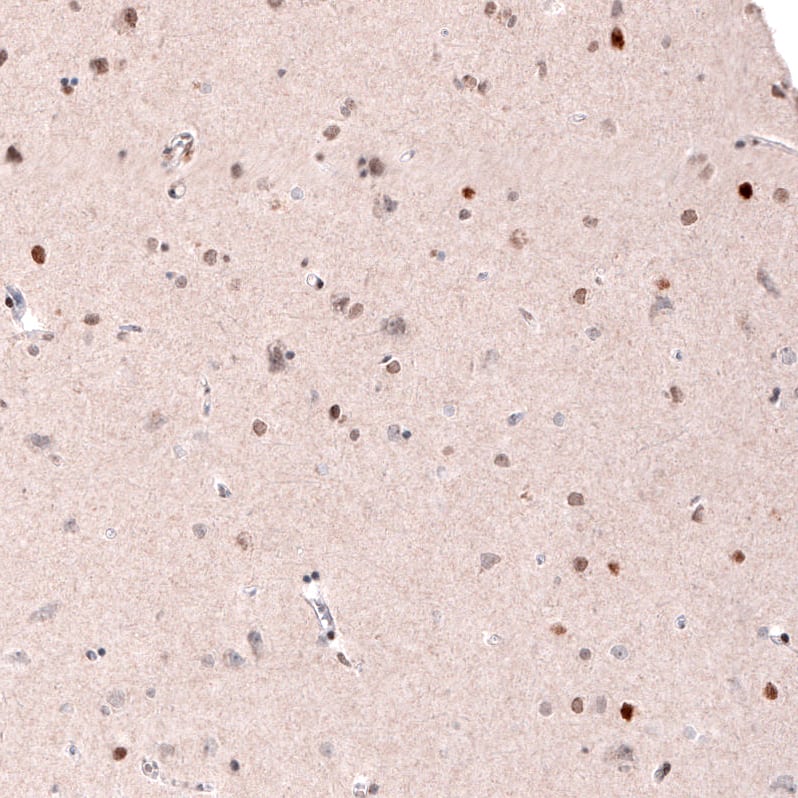 CDP/CUTL1 Antibody (CL5278) - Azide and BSA Free Immunohistochemistry-Paraffin: CDP/CUTL1 Antibody [NBP3-43965]