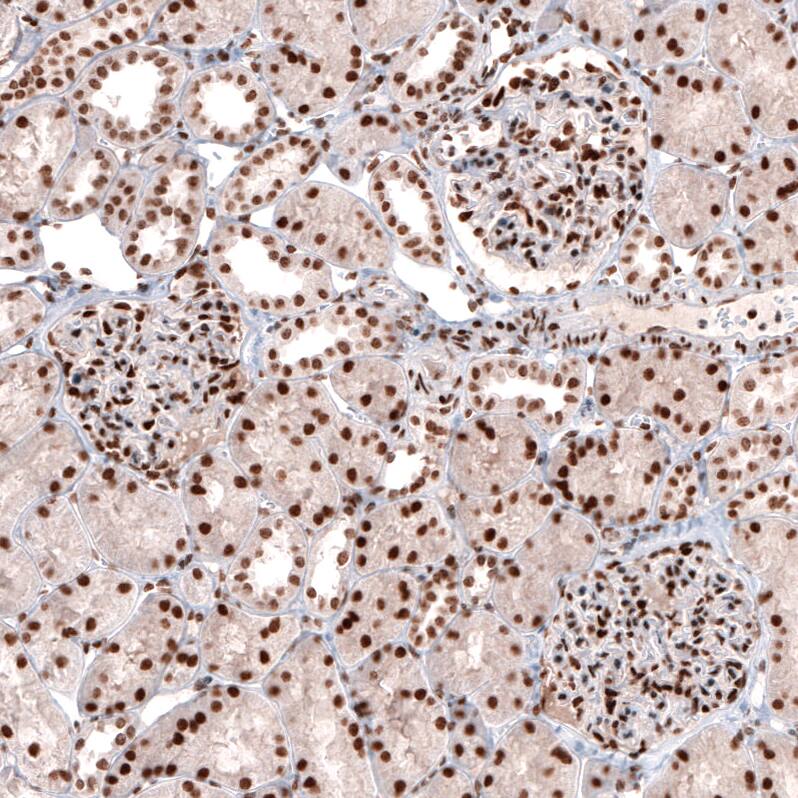 CDP/CUTL1 Antibody (CL5278) - Azide and BSA Free Immunohistochemistry-Paraffin: CDP/CUTL1 Antibody [NBP3-43965]