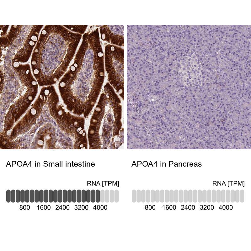 Apolipoprotein A-IV/ApoA4 Antibody (CL0465) - Azide and BSA Free Immunohistochemistry-Paraffin: Apolipoprotein A-IV/ApoA4 Antibody [NBP3-43967]