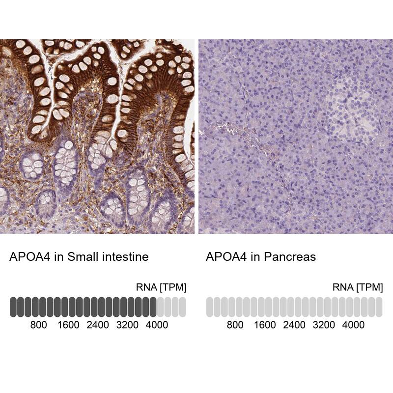 Apolipoprotein A-IV/ApoA4 Antibody (CL0467) - Azide and BSA Free Immunohistochemistry-Paraffin: Apolipoprotein A-IV/ApoA4 Antibody [NBP3-43968]