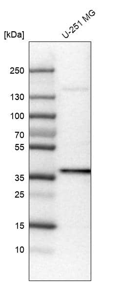 USP46 Antibody (CL0364) - Azide and BSA Free Western Blot: USP46 Antibody [NBP3-43970]