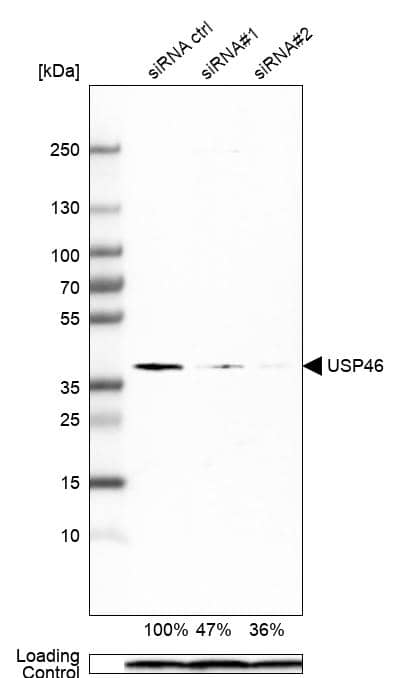 USP46 Antibody (CL0363) - Azide and BSA Free Western Blot: USP46 Antibody [NBP3-43971]