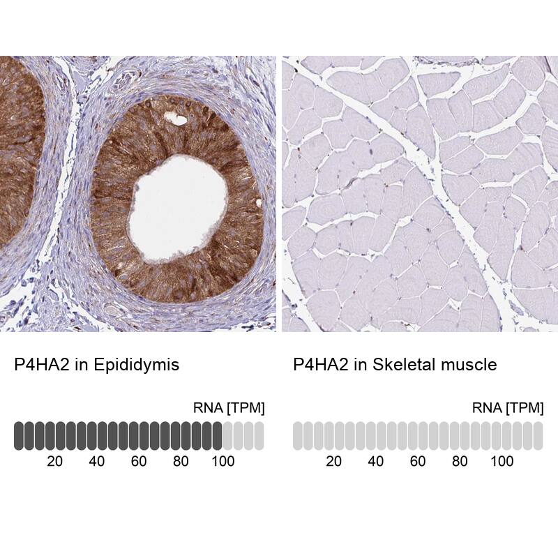 P4HA2 Antibody (CL0351) - Azide and BSA Free Immunohistochemistry-Paraffin: P4HA2 Antibody [NBP3-43972]