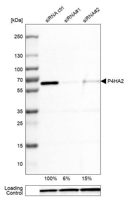 P4HA2 Antibody (CL0351) - Azide and BSA Free Western Blot: P4HA2 Antibody [NBP3-43972]