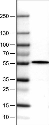 NAPRT1 Antibody (CL0366) - Azide and BSA Free Western Blot: NAPRT1 Antibody [NBP3-43973]