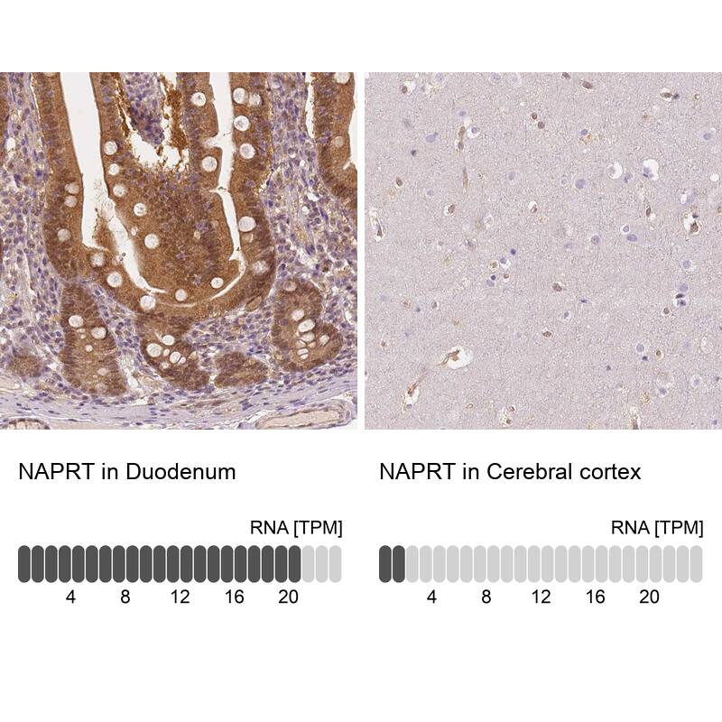 NAPRT1 Antibody (CL0366) - Azide and BSA Free Immunohistochemistry-Paraffin: NAPRT1 Antibody [NBP3-43973]