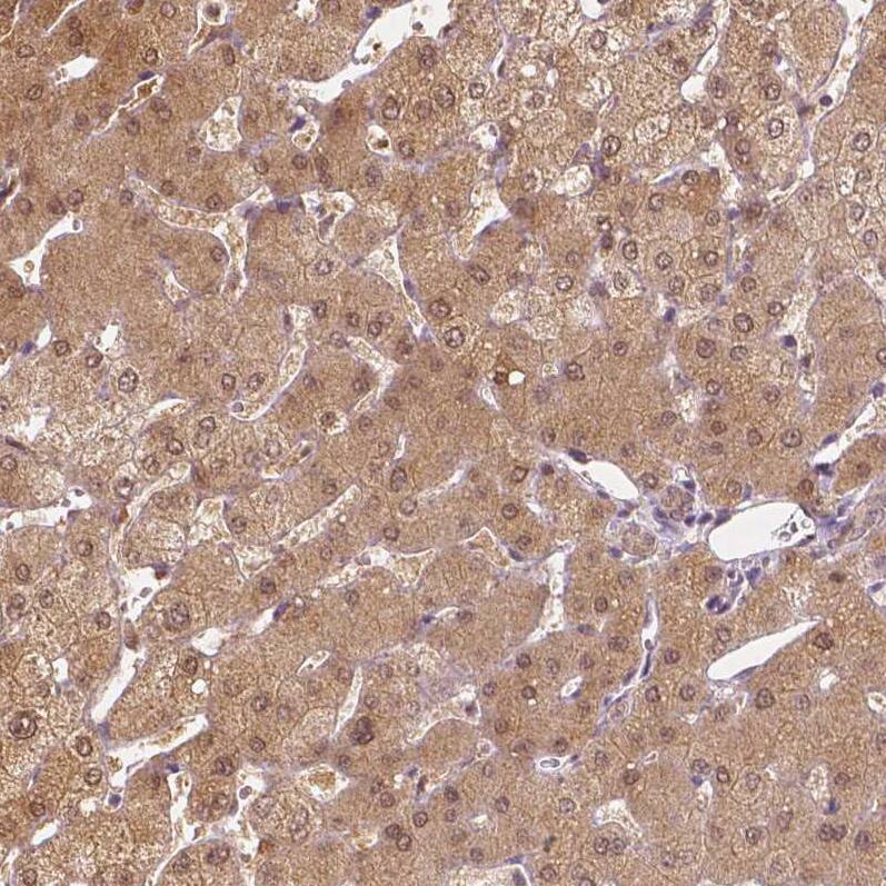 NAPRT1 Antibody (CL0366) - Azide and BSA Free Immunohistochemistry-Paraffin: NAPRT1 Antibody [NBP3-43973]