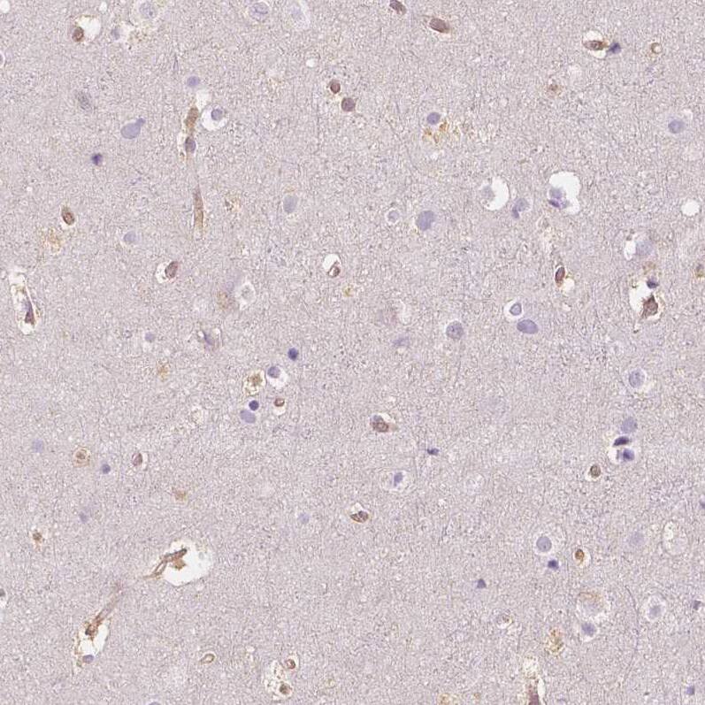NAPRT1 Antibody (CL0366) - Azide and BSA Free Immunohistochemistry-Paraffin: NAPRT1 Antibody [NBP3-43973]