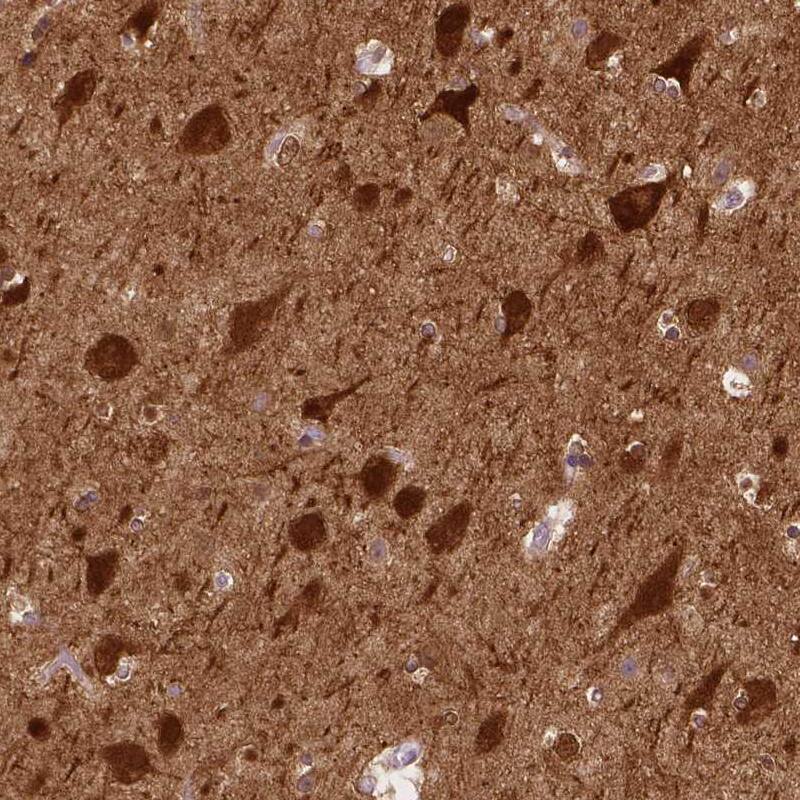 NECAB1 Antibody (CL0576) - Azide and BSA Free Immunohistochemistry-Paraffin: NECAB1 Antibody [NBP3-43976]