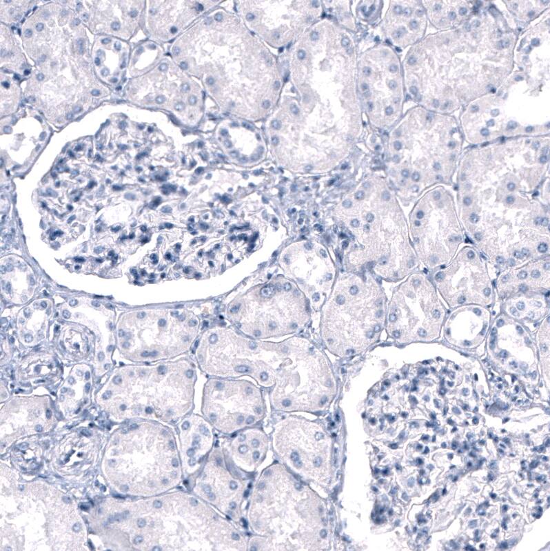 Myelin PLP Antibody (CL10622) - Azide and BSA Free Immunohistochemistry-Paraffin: Myelin PLP Antibody [NBP3-43977]