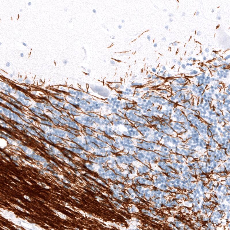 Myelin PLP Antibody (CL10622) - Azide and BSA Free Immunohistochemistry-Paraffin: Myelin PLP Antibody [NBP3-43977]